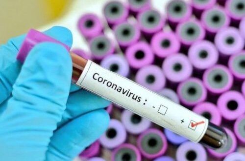 Article : Coronavirus, en Afrique on croyait à une « affaire de blancs »