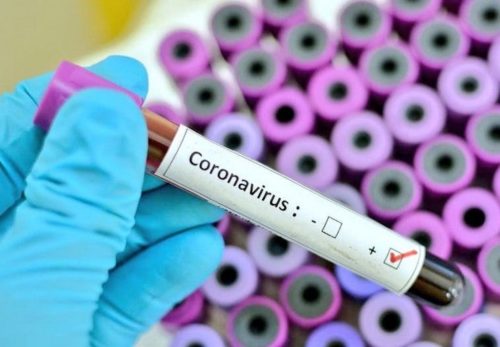 Article : Coronavirus, en Afrique on croyait à une « affaire de blancs »
